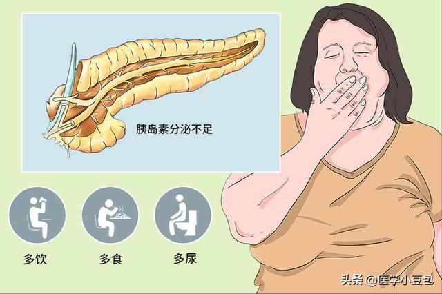  血糖波动背后的代谢机制：瑞金医院临床研究揭示限时进食干预潜力 健康养生